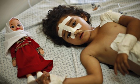 Shayma al-Masri, 4, a girl injured in an Israeli air strike on Gaza that killed her mother