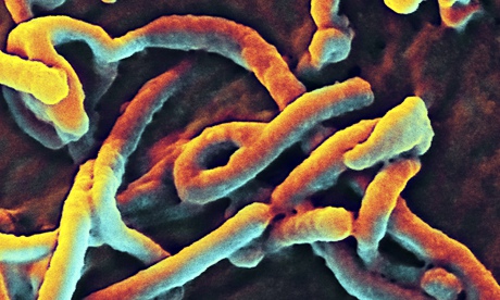 Microscopic view Of Ebola virus